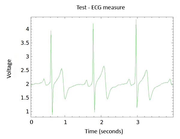 KST program shows the ECG wave